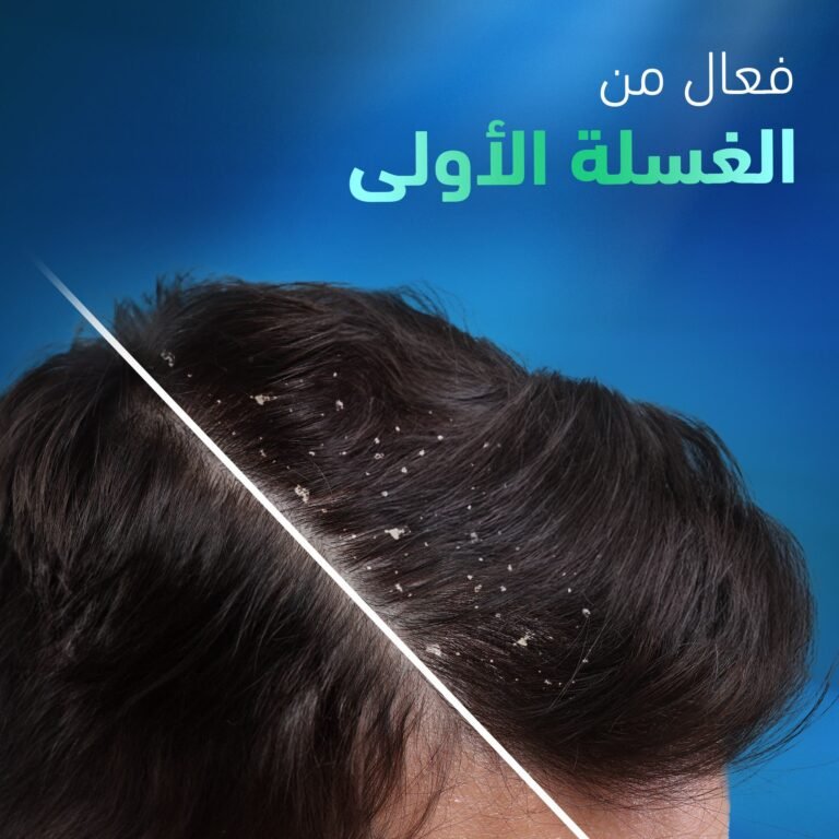 Head & Shoulders Shampoo For Severe Itchy Scalp 400 Ml - Image 5