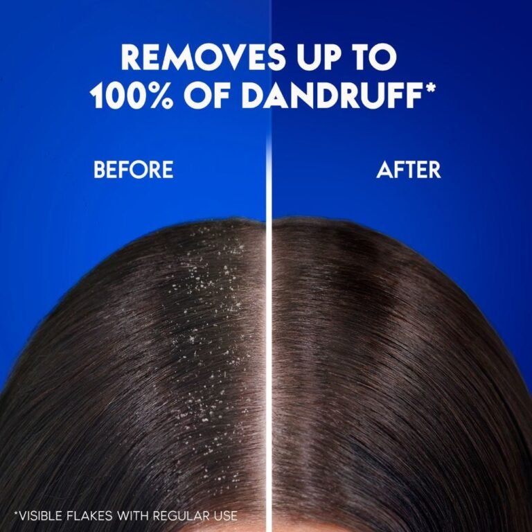 Head & Shoulders Citrus Fresh Anti-Dandruff Shampoo, 200 ml - Image 2
