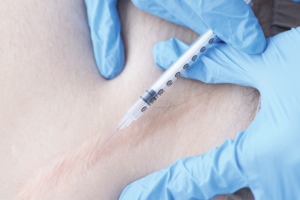 علاج الندبات بالحقن